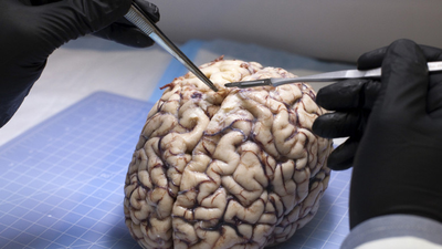 ΠΊΠ°ΠΊΠΈΠΌ ΡΠ²Π΅ΡΠΎΠΌ ΡΠ΅Π»ΠΎΠ²Π΅ΡΠ΅ΡΠΊΠΈΠΉ ΠΌΠΎΠ·Π³. Π‘ΠΌΠΎΡΡΠ΅ΡΡ ΡΠΎΡΠΎ ΠΊΠ°ΠΊΠΈΠΌ ΡΠ²Π΅ΡΠΎΠΌ ΡΠ΅Π»ΠΎΠ²Π΅ΡΠ΅ΡΠΊΠΈΠΉ ΠΌΠΎΠ·Π³. Π‘ΠΌΠΎΡΡΠ΅ΡΡ ΠΊΠ°ΡΡΠΈΠ½ΠΊΡ ΠΊΠ°ΠΊΠΈΠΌ ΡΠ²Π΅ΡΠΎΠΌ ΡΠ΅Π»ΠΎΠ²Π΅ΡΠ΅ΡΠΊΠΈΠΉ ΠΌΠΎΠ·Π³. ΠΠ°ΡΡΠΈΠ½ΠΊΠ° ΠΏΡΠΎ ΠΊΠ°ΠΊΠΈΠΌ ΡΠ²Π΅ΡΠΎΠΌ ΡΠ΅Π»ΠΎΠ²Π΅ΡΠ΅ΡΠΊΠΈΠΉ ΠΌΠΎΠ·Π³. Π€ΠΎΡΠΎ ΠΊΠ°ΠΊΠΈΠΌ ΡΠ²Π΅ΡΠΎΠΌ ΡΠ΅Π»ΠΎΠ²Π΅ΡΠ΅ΡΠΊΠΈΠΉ ΠΌΠΎΠ·Π³ ΠΊΠ°ΠΊΠΈΠΌ ΡΠ²Π΅ΡΠΎΠΌ ΡΠ΅Π»ΠΎΠ²Π΅ΡΠ΅ΡΠΊΠΈΠΉ ΠΌΠΎΠ·Π³. Π‘ΠΌΠΎΡΡΠ΅ΡΡ ΡΠΎΡΠΎ ΠΊΠ°ΠΊΠΈΠΌ ΡΠ²Π΅ΡΠΎΠΌ ΡΠ΅Π»ΠΎΠ²Π΅ΡΠ΅ΡΠΊΠΈΠΉ ΠΌΠΎΠ·Π³. Π‘ΠΌΠΎΡΡΠ΅ΡΡ ΠΊΠ°ΡΡΠΈΠ½ΠΊΡ ΠΊΠ°ΠΊΠΈΠΌ ΡΠ²Π΅ΡΠΎΠΌ ΡΠ΅Π»ΠΎΠ²Π΅ΡΠ΅ΡΠΊΠΈΠΉ ΠΌΠΎΠ·Π³. ΠΠ°ΡΡΠΈΠ½ΠΊΠ° ΠΏΡΠΎ ΠΊΠ°ΠΊΠΈΠΌ ΡΠ²Π΅ΡΠΎΠΌ ΡΠ΅Π»ΠΎΠ²Π΅ΡΠ΅ΡΠΊΠΈΠΉ ΠΌΠΎΠ·Π³. Π€ΠΎΡΠΎ ΠΊΠ°ΠΊΠΈΠΌ ΡΠ²Π΅ΡΠΎΠΌ ΡΠ΅Π»ΠΎΠ²Π΅ΡΠ΅ΡΠΊΠΈΠΉ ΠΌΠΎΠ·Π³