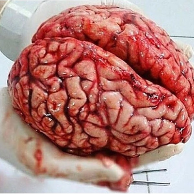 ΠΊΠ°ΠΊΠΈΠΌ ΡΠ²Π΅ΡΠΎΠΌ ΡΠ΅Π»ΠΎΠ²Π΅ΡΠ΅ΡΠΊΠΈΠΉ ΠΌΠΎΠ·Π³. Π‘ΠΌΠΎΡΡΠ΅ΡΡ ΡΠΎΡΠΎ ΠΊΠ°ΠΊΠΈΠΌ ΡΠ²Π΅ΡΠΎΠΌ ΡΠ΅Π»ΠΎΠ²Π΅ΡΠ΅ΡΠΊΠΈΠΉ ΠΌΠΎΠ·Π³. Π‘ΠΌΠΎΡΡΠ΅ΡΡ ΠΊΠ°ΡΡΠΈΠ½ΠΊΡ ΠΊΠ°ΠΊΠΈΠΌ ΡΠ²Π΅ΡΠΎΠΌ ΡΠ΅Π»ΠΎΠ²Π΅ΡΠ΅ΡΠΊΠΈΠΉ ΠΌΠΎΠ·Π³. ΠΠ°ΡΡΠΈΠ½ΠΊΠ° ΠΏΡΠΎ ΠΊΠ°ΠΊΠΈΠΌ ΡΠ²Π΅ΡΠΎΠΌ ΡΠ΅Π»ΠΎΠ²Π΅ΡΠ΅ΡΠΊΠΈΠΉ ΠΌΠΎΠ·Π³. Π€ΠΎΡΠΎ ΠΊΠ°ΠΊΠΈΠΌ ΡΠ²Π΅ΡΠΎΠΌ ΡΠ΅Π»ΠΎΠ²Π΅ΡΠ΅ΡΠΊΠΈΠΉ ΠΌΠΎΠ·Π³ ΠΊΠ°ΠΊΠΈΠΌ ΡΠ²Π΅ΡΠΎΠΌ ΡΠ΅Π»ΠΎΠ²Π΅ΡΠ΅ΡΠΊΠΈΠΉ ΠΌΠΎΠ·Π³. Π‘ΠΌΠΎΡΡΠ΅ΡΡ ΡΠΎΡΠΎ ΠΊΠ°ΠΊΠΈΠΌ ΡΠ²Π΅ΡΠΎΠΌ ΡΠ΅Π»ΠΎΠ²Π΅ΡΠ΅ΡΠΊΠΈΠΉ ΠΌΠΎΠ·Π³. Π‘ΠΌΠΎΡΡΠ΅ΡΡ ΠΊΠ°ΡΡΠΈΠ½ΠΊΡ ΠΊΠ°ΠΊΠΈΠΌ ΡΠ²Π΅ΡΠΎΠΌ ΡΠ΅Π»ΠΎΠ²Π΅ΡΠ΅ΡΠΊΠΈΠΉ ΠΌΠΎΠ·Π³. ΠΠ°ΡΡΠΈΠ½ΠΊΠ° ΠΏΡΠΎ ΠΊΠ°ΠΊΠΈΠΌ ΡΠ²Π΅ΡΠΎΠΌ ΡΠ΅Π»ΠΎΠ²Π΅ΡΠ΅ΡΠΊΠΈΠΉ ΠΌΠΎΠ·Π³. Π€ΠΎΡΠΎ ΠΊΠ°ΠΊΠΈΠΌ ΡΠ²Π΅ΡΠΎΠΌ ΡΠ΅Π»ΠΎΠ²Π΅ΡΠ΅ΡΠΊΠΈΠΉ ΠΌΠΎΠ·Π³