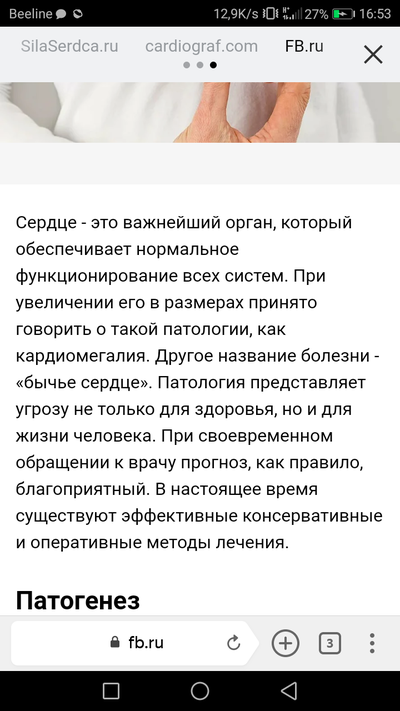 Иллюстрация к комментарию