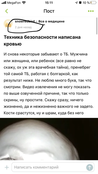 Иллюстрация к комментарию