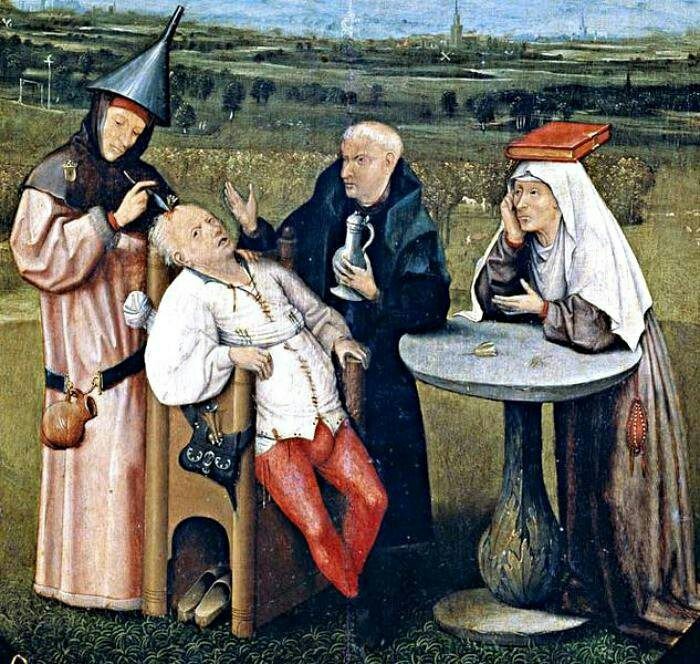 Пять ужасов средневековой медицины Медицина, Средневековье, Лечение, Длиннопост