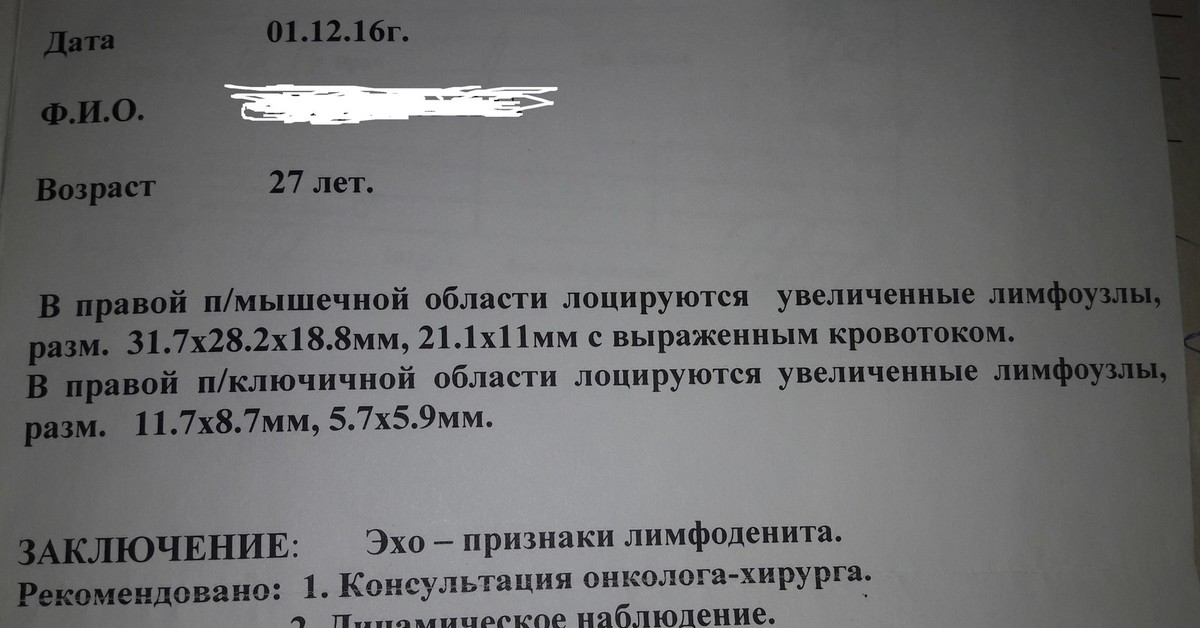 Эхопризнаки лимфаденопатии. Лимфаденопатия УЗИ признаки. Лимфоаденопатия заключения УЗИ.