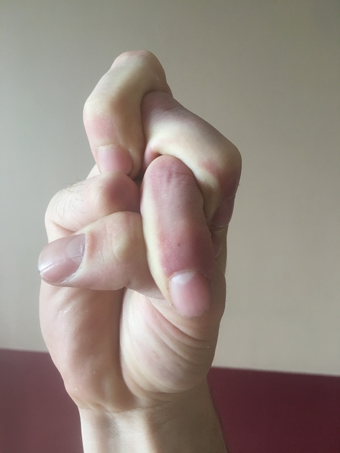 ��������� �������?