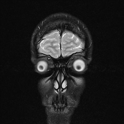 MRI of my face© - MRI, The photo, Reddit