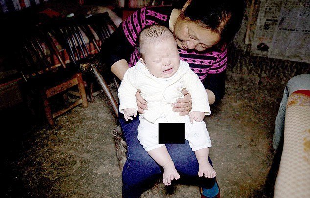 A boy with 31 fingers was born in China (5 photos) - Interesting, Facts, Peace, Interesting people, People, China, Fingers, Disease, Longpost