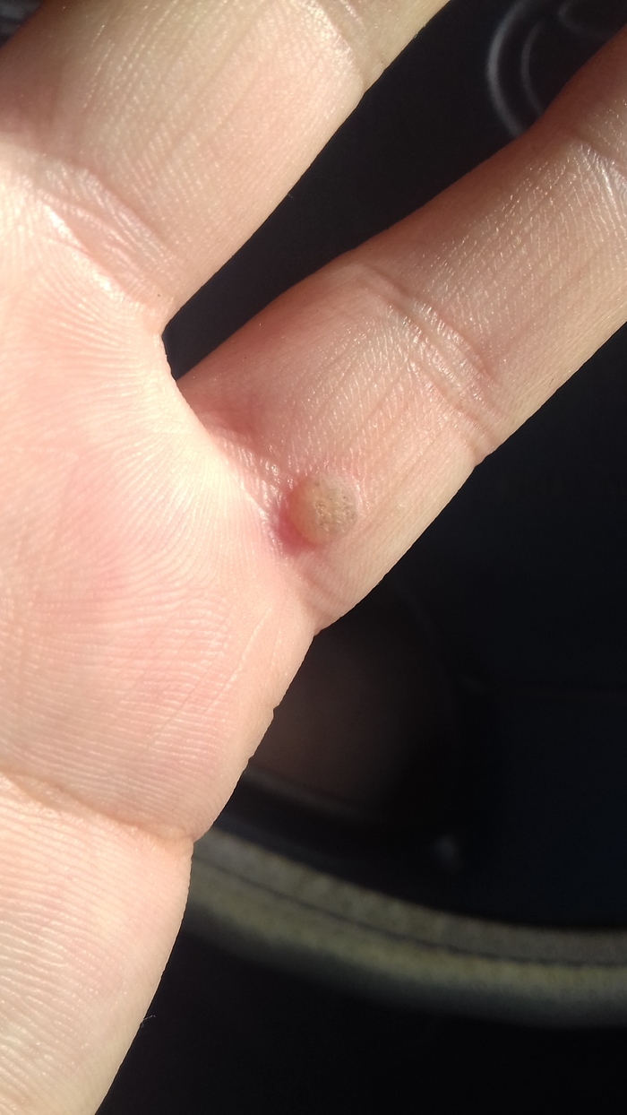 Помощи прошу