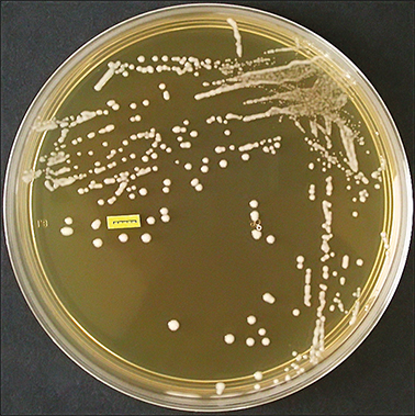    , Paenibacillus larvae, , ,  , 