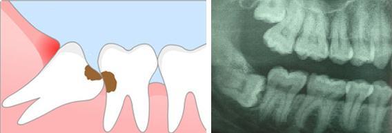 Dentistry. - My, Dentistry, The medicine, Teeth, Longpost