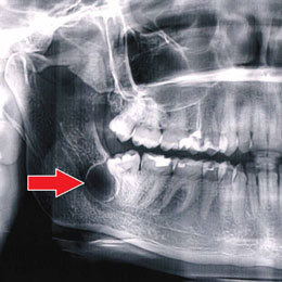 Dentistry. - My, Dentistry, The medicine, Teeth, Longpost