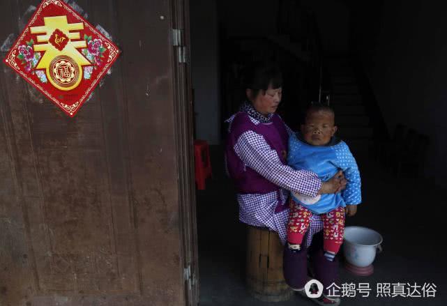 31-year-old Chinese man trapped in the body of a 4-year-old child - Children, China, Ugliness, A son, Unusual, Longpost