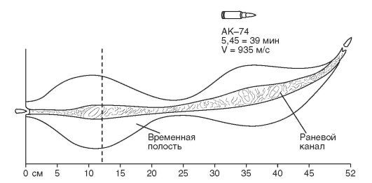 Пуля и плоть: неравное противостояние. Часть 2 - Лига историков, Раневая баллистика, Военная медицина, Огнестрельные ранения, История медицины, Длиннопост, Баллистика, Ранение