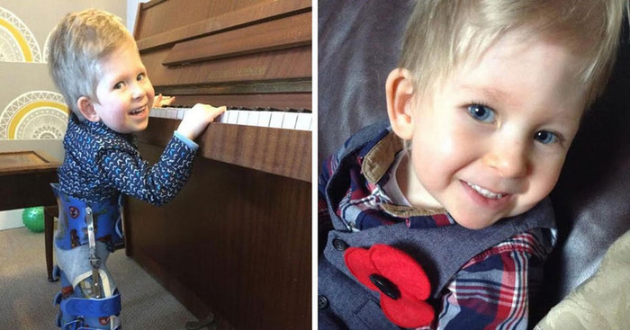 Мальчик без мозга, который смог Мозг, Аномалия, Удивительные люди, Медицина, Дети, Длиннопост