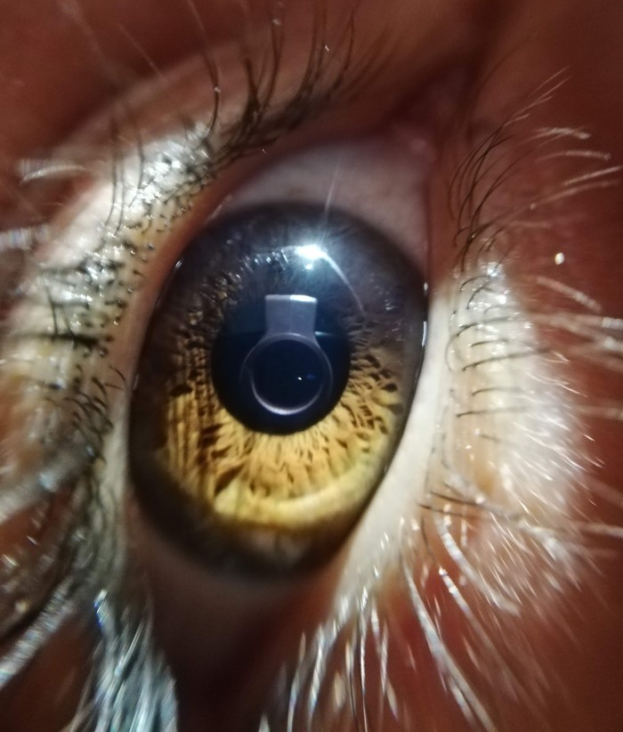 Electronic Vision , Iris