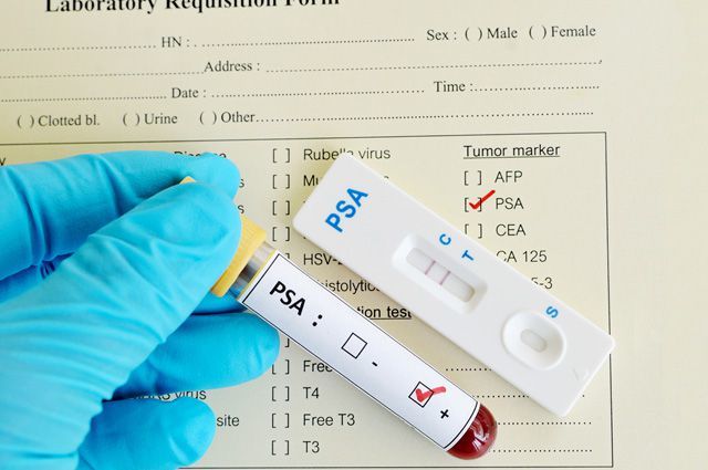 tumor markers - Oncology, Crayfish, The medicine, Tumor marker, Longpost