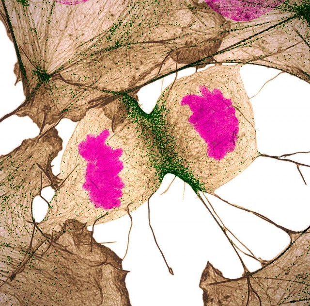 20 winners of Nikon Small World Microphotography 2018 - The photo, Microfilming, Macro, Longpost, Microfilming, Macro photography