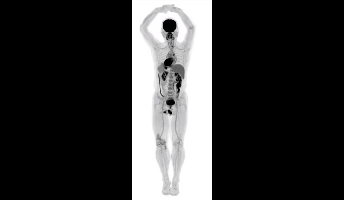 First image captured from world's first full body scanner - The medicine, Technologies, Scanner, Video