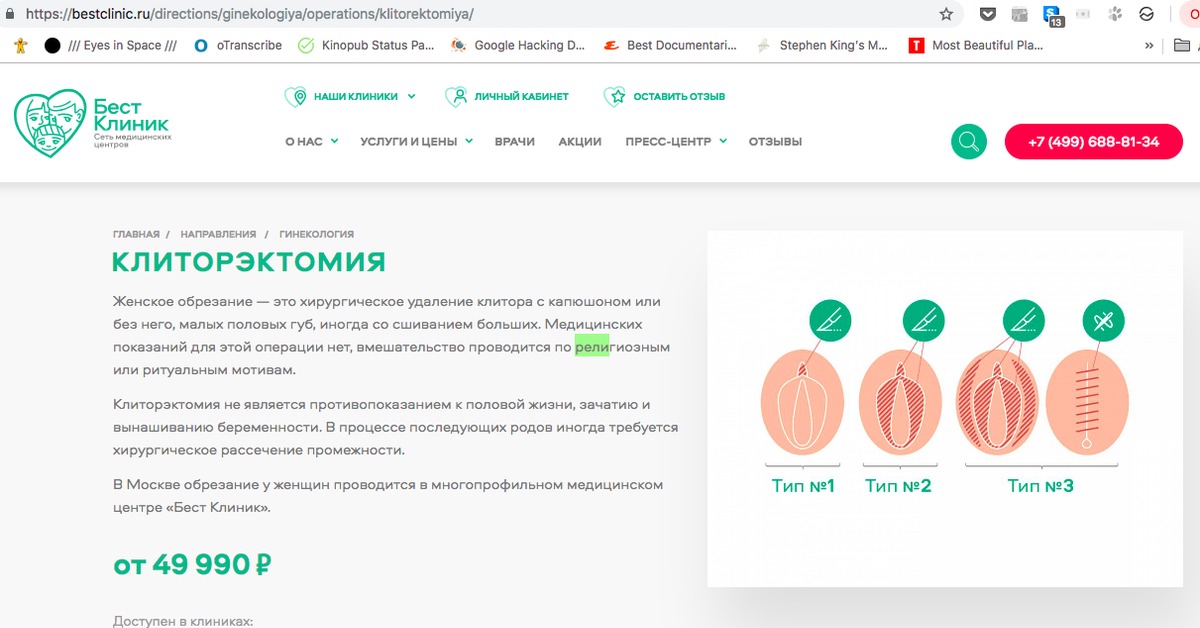 Обрезание В Москве Цена