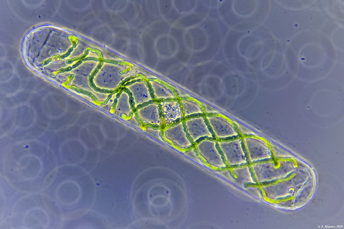 seaweed - My, Microscope, Spirogyra, Seaweed