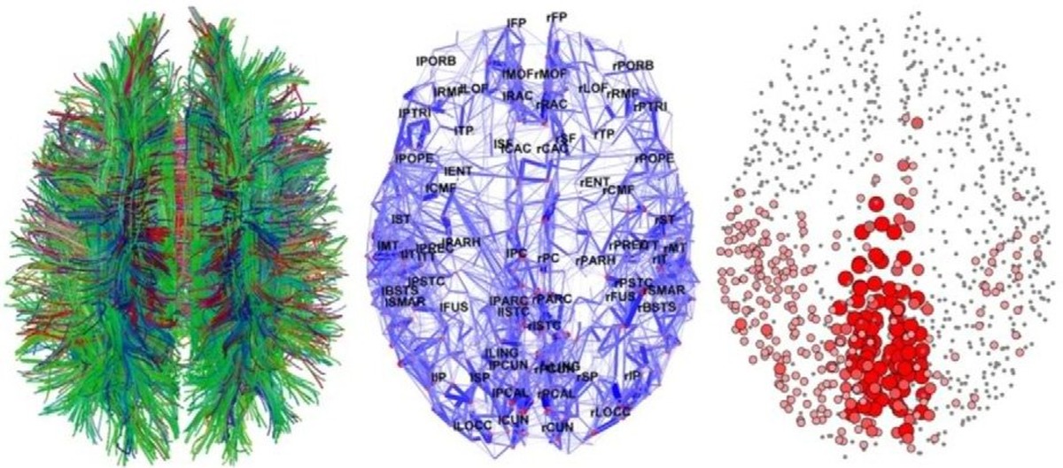 Diffusion нейросеть. Коннектом сеть мозга. Нейросетевая модель мозга. Карта нейронных связей мозга. Объемная модель птичьего мозга.