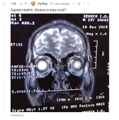 Photogenicity is everything! - Screenshot, Comments, Comments on Peekaboo, MRI, Snapshot, Photogenic, Longpost, The photo