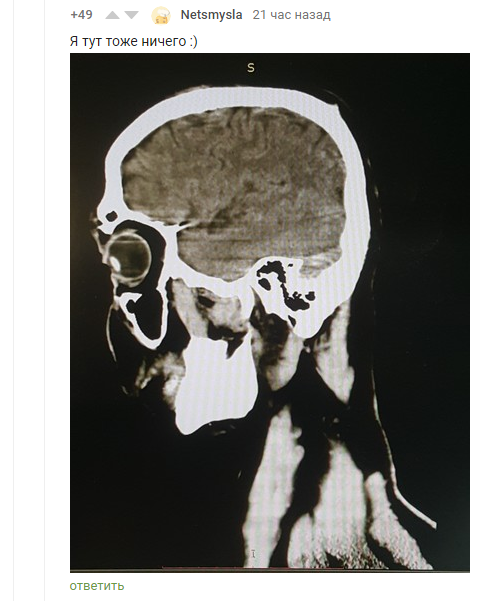 Photogenicity is everything! - Screenshot, Comments, Comments on Peekaboo, MRI, Snapshot, Photogenic, Longpost, The photo