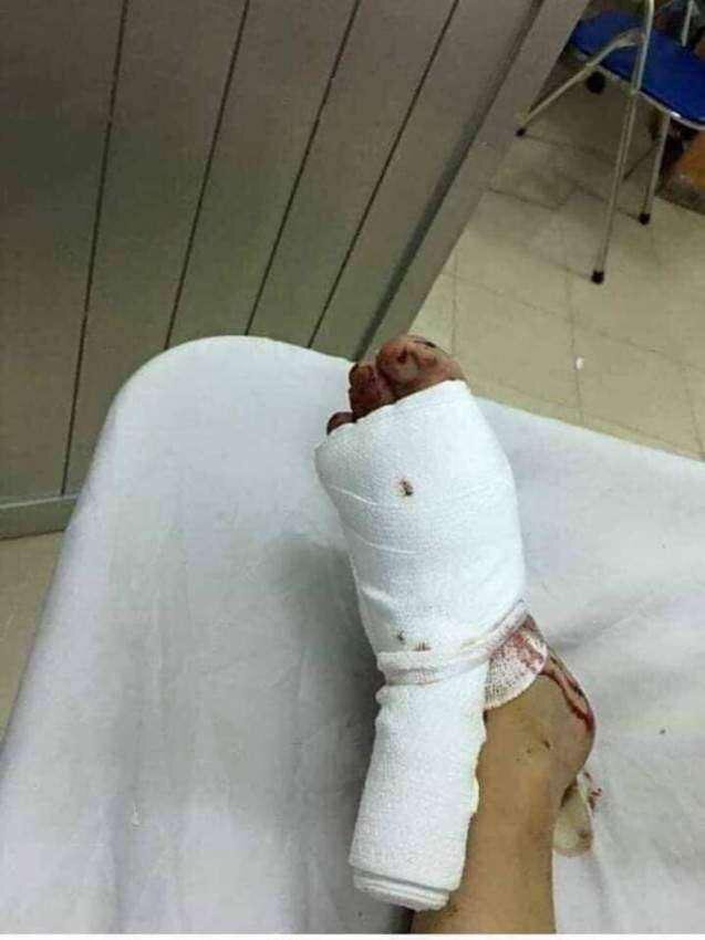 Wife tried to seduce her husband with snake stockings and ended up in the hospital - Tunisia, Stockings, Snake, Oddities, Longpost