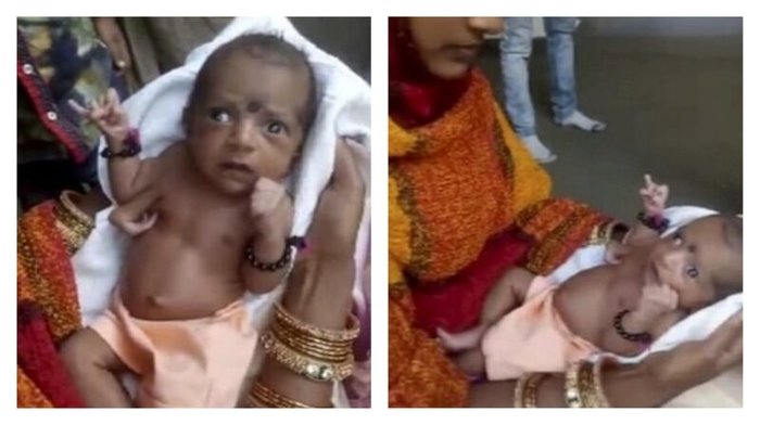 Three-armed baby girl is worshiped as a deity - Children, Anomaly, Deity, India