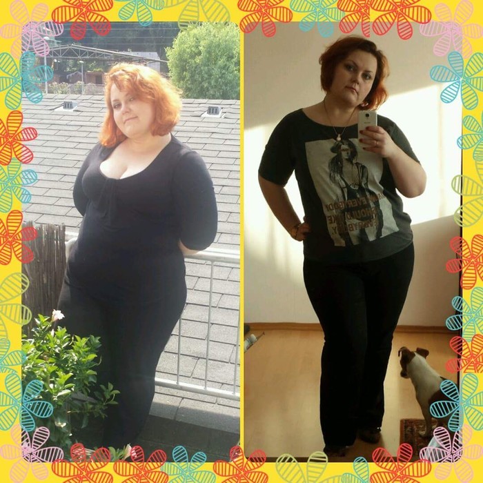 bariatric surgery. Why did I decide? Post N°3. - My, Slimming, Operation, Longpost