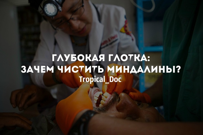 ГЛУБОКАЯ ГЛОТКА: ЗАЧЕМ ЧИСТИТЬ МИНДАЛИНЫ?