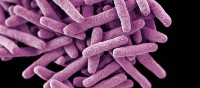 Tuberculosis: managing the bacterial mechanism of suicide - My, The science, The medicine, Tuberculosis, Bacteria, Toxins, Research