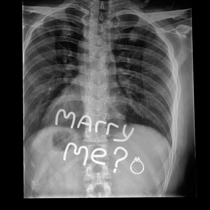 “My friend’s girlfriend is a radiologist. A friend proposed to her: he soldered letters from wire and glued them on his stomach with tape, along with a ring. - X-ray, Sentence, Ring, Reddit