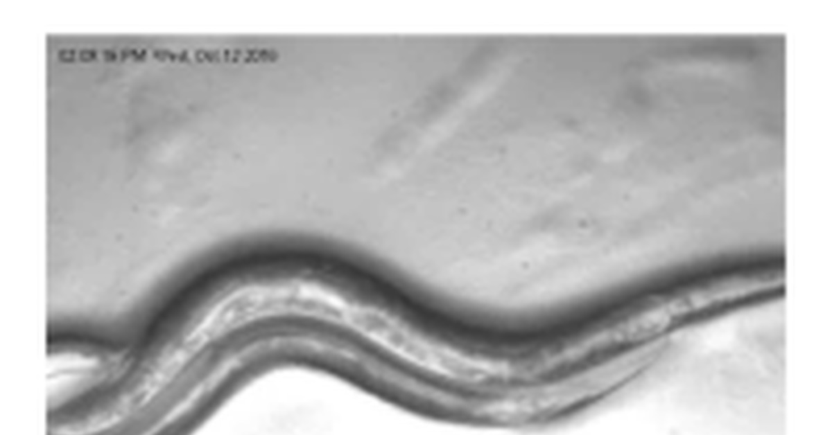 Половые органы человека гермафродита. Нематода Caenorhabditis elegans. Сперматозоиды Caenorhabditis elegans. Гермафродиты крупным планом.