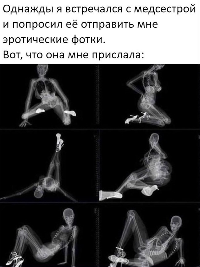 Can you add strawberries like this? - X-ray, Nurses, Picture with text, The photo