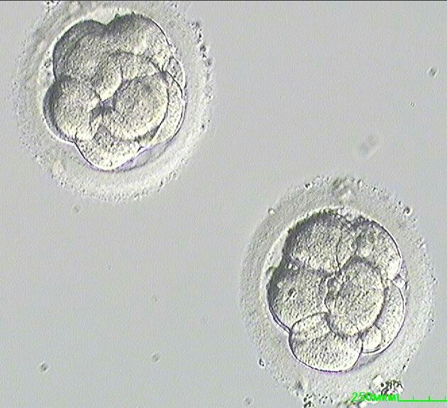 Embryo development - My, ECO, Embryo, Embryology, Video, Longpost