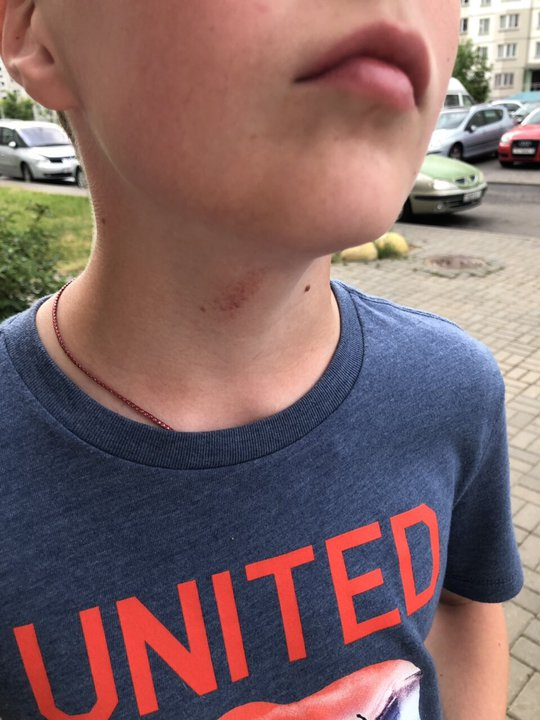 Come on, hit harder! How a quarrel on the playground ended with a call to the police - Children, Lazy, Argument, Beating, Playground, Tutby, news, Video, Longpost, Negative, TUT by