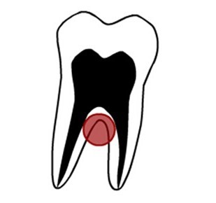 How a tooth extraction led to TMJ problems. Part 2. - My, Dentistry, Extraction of teeth, TMJ dysfunction, Massage, Dentist, , Longpost, Muscle