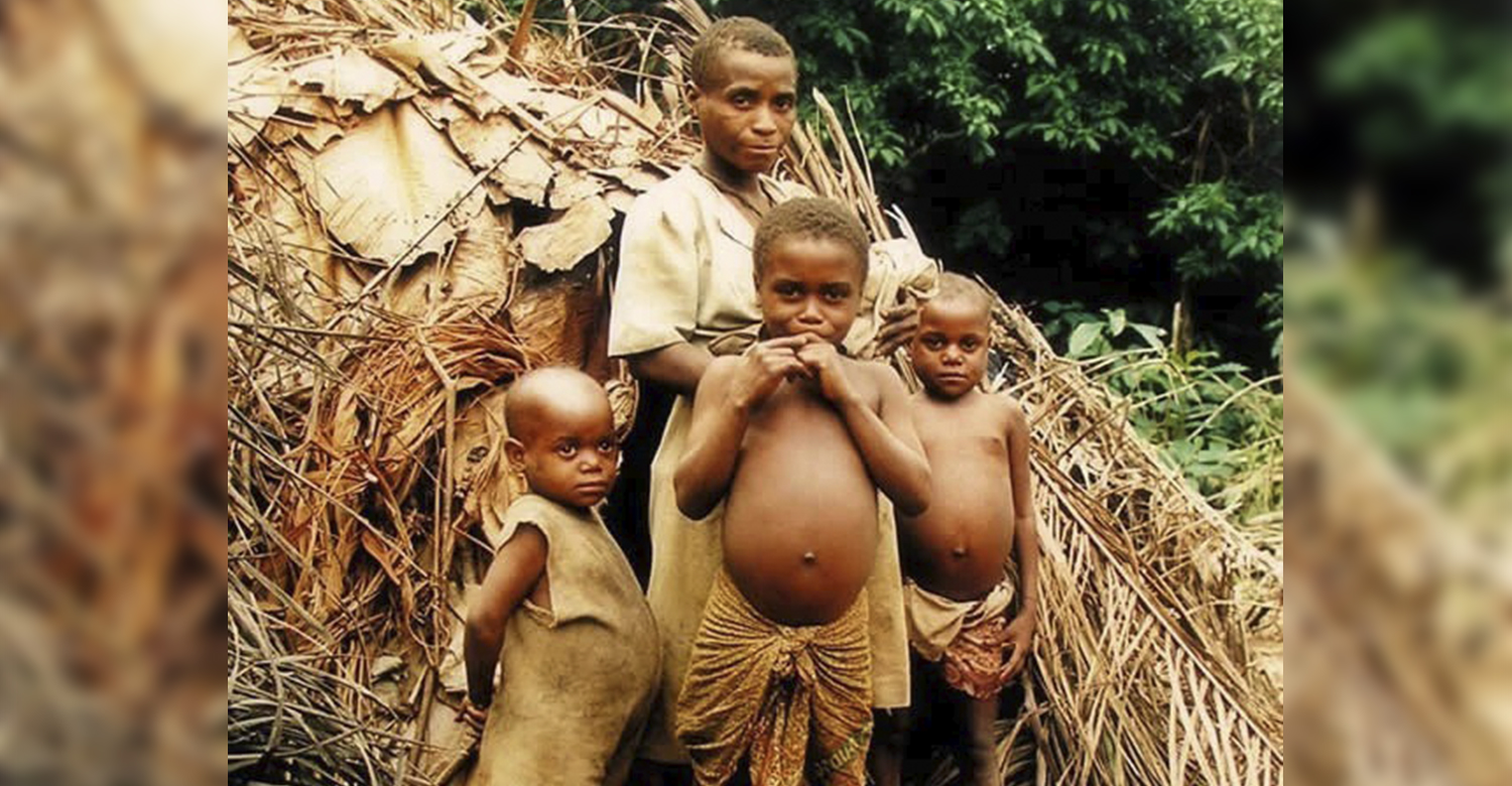 Урчание от голода. Африканские дети большие животы. Африканские дети с животами. Африканские Дели с жмвотом.
