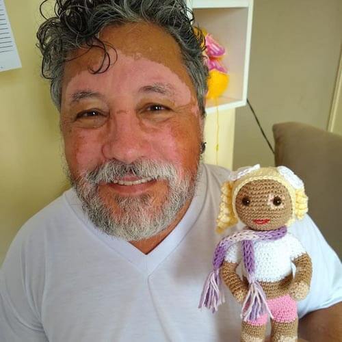 Grandpa knits Vitiligo dolls to support children who are different - Creation, Children, Kindness, Elderly, Longpost, Vitiligo, Knitted toys