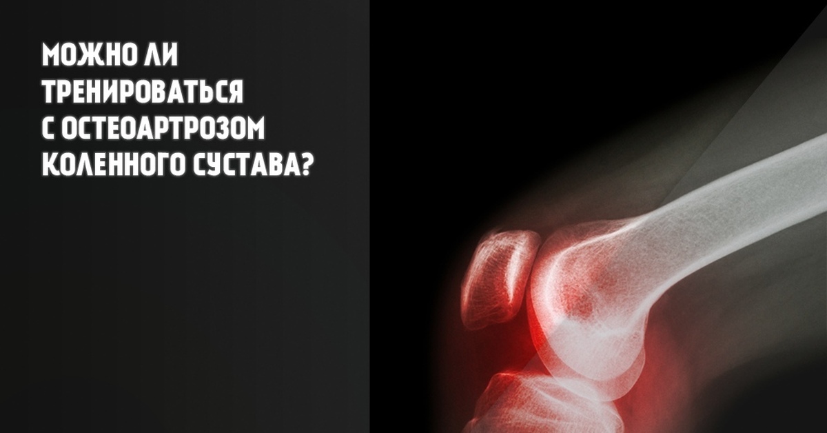 Оа суставов. Наиболее распространенные заболевания суставов. спорт суставы. спортивные советы дзен.