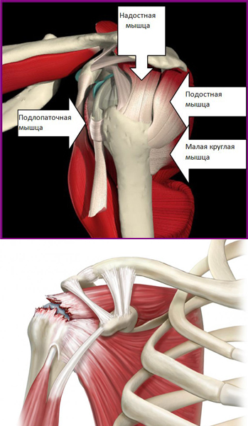 Arthroscopy - My, The medicine, Medicine in Russia, Longpost, Arthroscopy