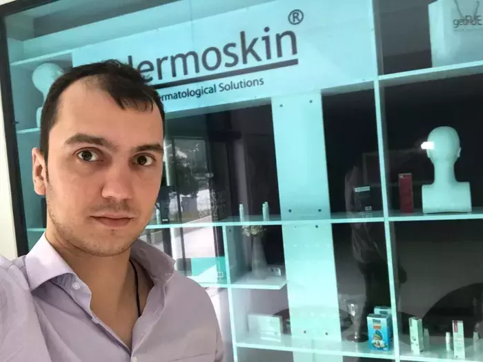 ÐеÑеÑадка Ð²Ð¾Ð»Ð¾Ñ Ð¼ÐµÑодом FUE в ТÑÑÑии ÐеÑеÑадка волоÑ, ÐблÑÑение, ÐлиннопоÑÑ