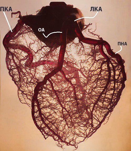 Сосуды сердца - Моё, Медицина, Здоровье, Сердце, Сосуды, Кардиология, Длиннопост