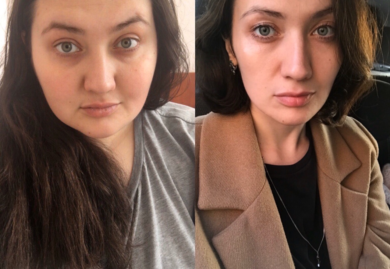 Лицо до и после похудения женщины