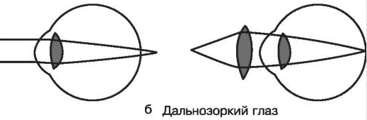 Laser vision correction - Ophthalmology, Eyes, Laser correction, Operation, Longpost