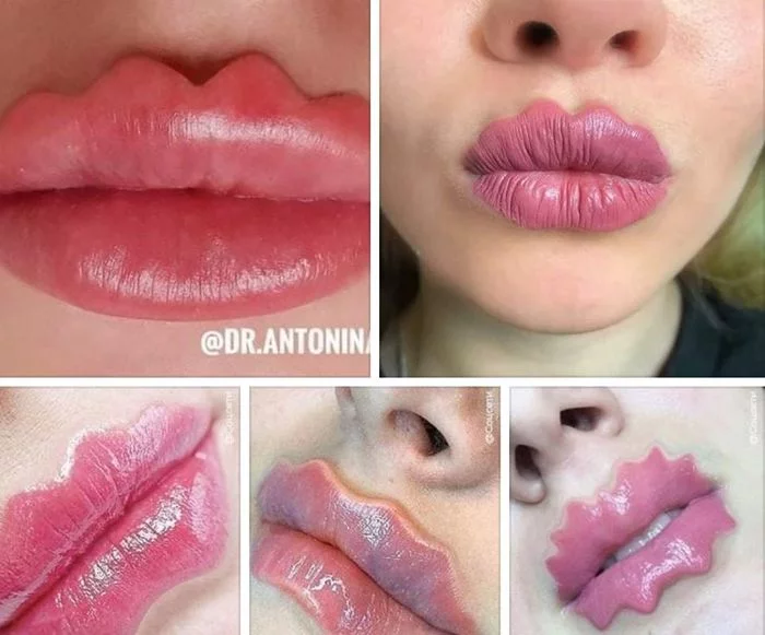 New trend for girls - Ugh, Trend, , , Lips