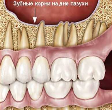 Особенности лечения зубов при простуде – в каких случаях визит к стоматологу становится необходимым