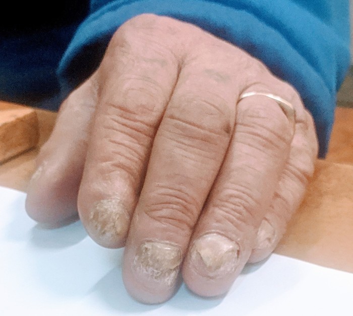 ���������� �������