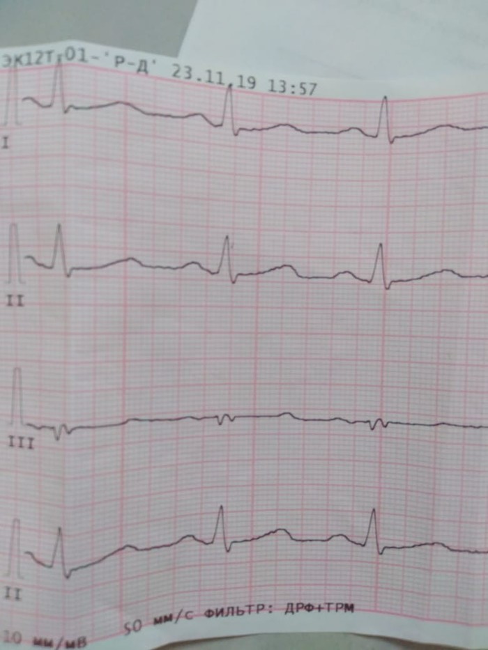   37 ,  , 