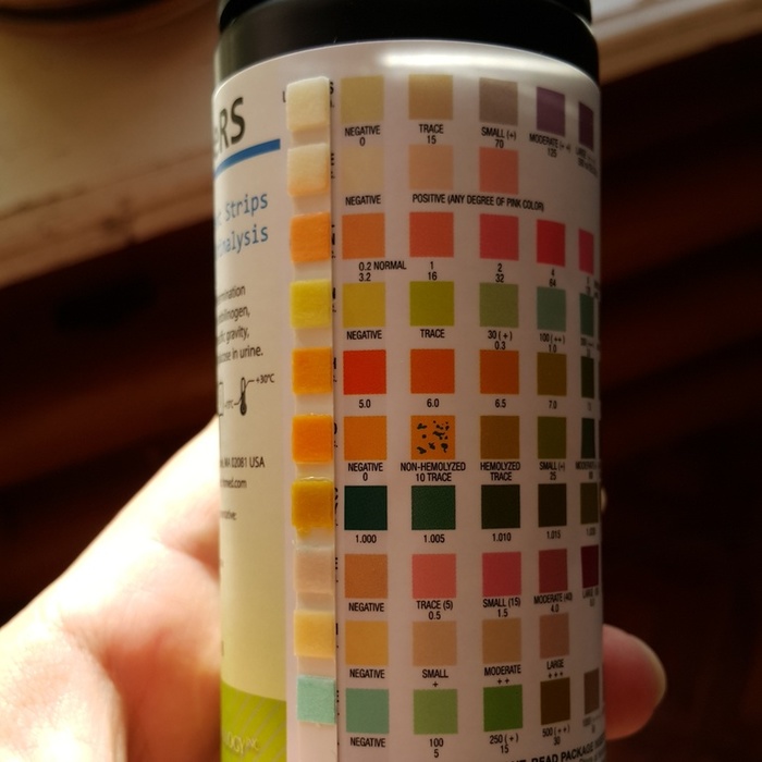 Как делают общий анализ мочи Анализ, Медицинские анализы, Лаборатория, Медицина, Длиннопост