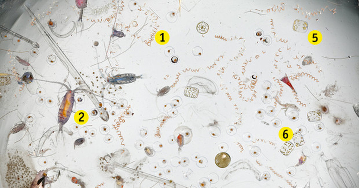 Морская вода бактерии. Вода под микроскопом. Микроорганизмы в капле воды. Микроорганизмы в воде под микроскопом. Микробы в воде под микроскопом.